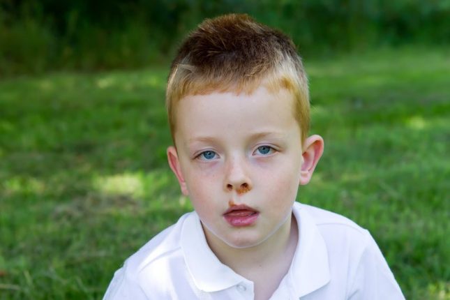 School sores - Impetigo