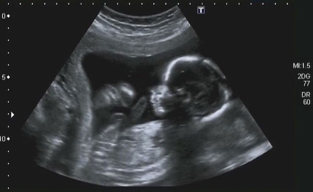 growth of the baby