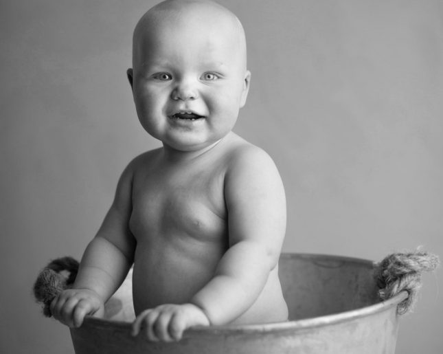 What is eczema? 11 tips to help your child what is eczema